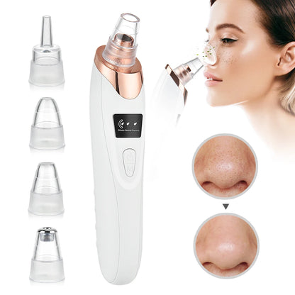 Removedor de Puntos Negros Limpiador Profundo Facial para Nariz y Zona T, Extractor de Acné y Espinillas por Succión al Vacío, Herramienta de Belleza Facial con Diamante para una Piel Limpia