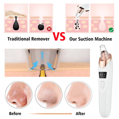 Removedor de Puntos Negros Limpiador Profundo Facial para Nariz y Zona T, Extractor de Acné y Espinillas por Succión al Vacío, Herramienta de Belleza Facial con Diamante para una Piel Limpia