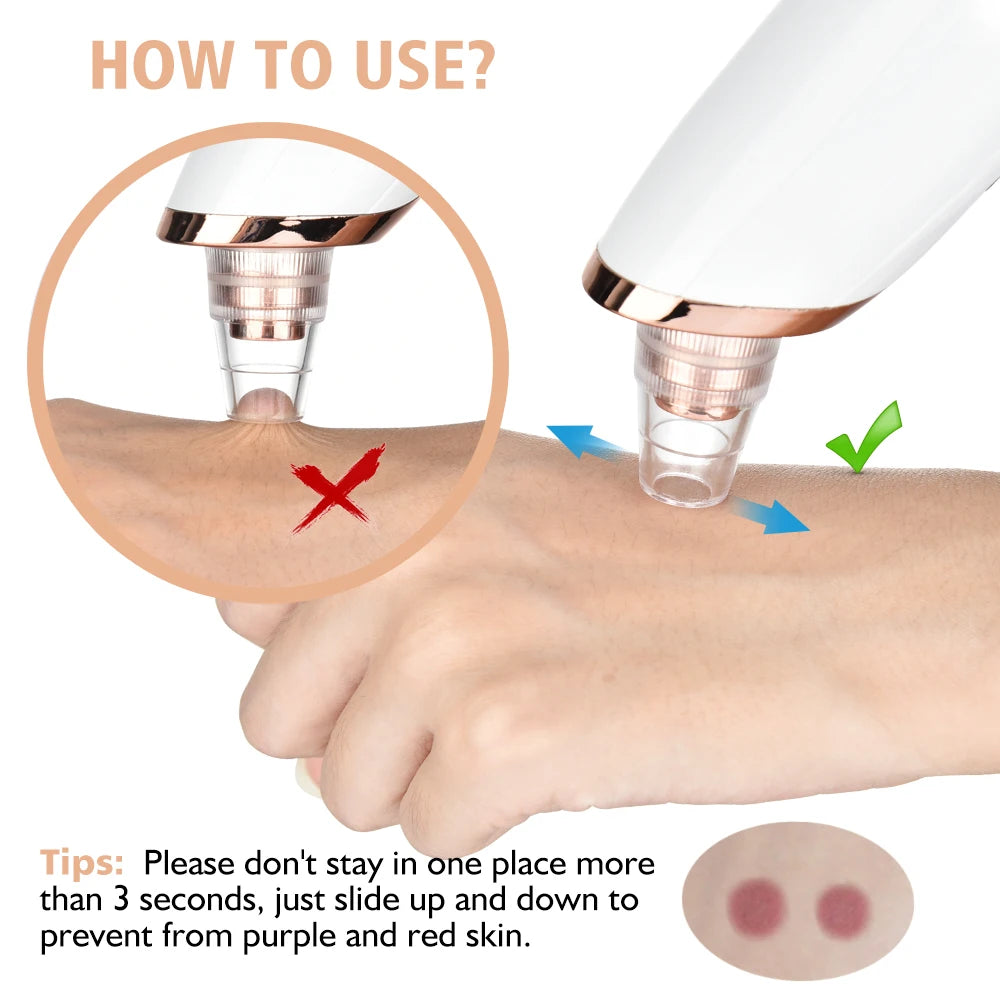 Removedor de Puntos Negros Limpiador Profundo Facial para Nariz y Zona T, Extractor de Acné y Espinillas por Succión al Vacío, Herramienta de Belleza Facial con Diamante para una Piel Limpia